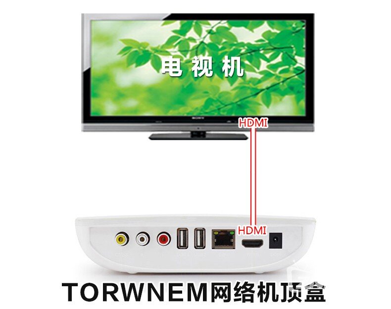 TORWNEM网络机顶盒接麦克风k歌插咪唱电视话筒卡拉ok唱歌
