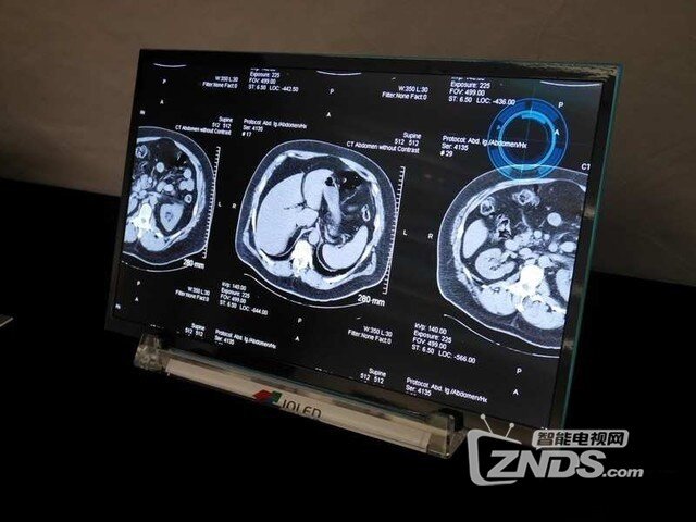 韩系集体颤抖！日本首款印刷式OLED诞生
